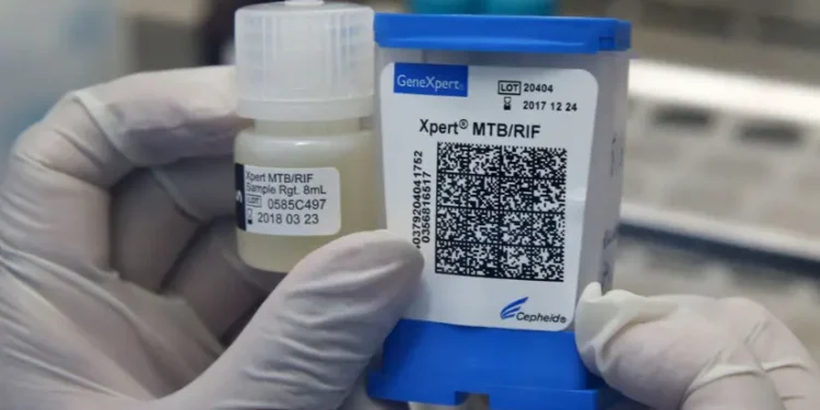 Un innovador test portátil permitirá detectar la tuberculosis en menos de una hora